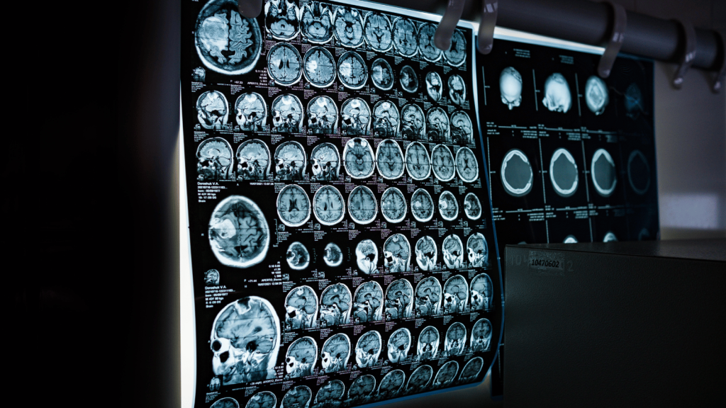 A lit panel displaying multiple rows of brain MRI scans in grayscale. Numerous cross-sections of the brain are arranged in a grid.