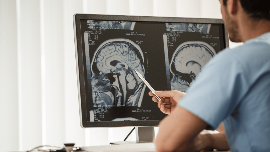 A medical professional in scrubs points at a brain MRI on a computer monitor using a pen. The screen shows detailed sagittal brain images.